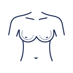 A drawing of a woman 's breast with no bra.