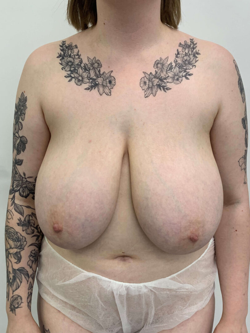 A woman with tattoos on her chest.