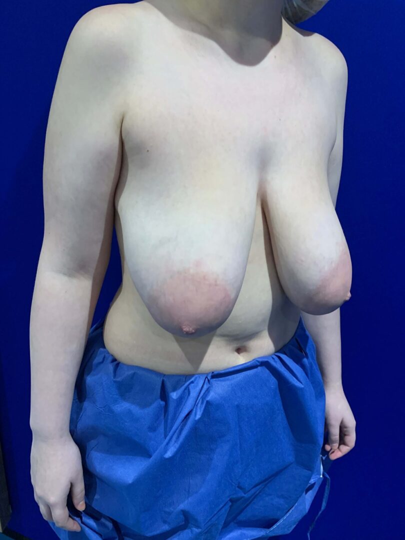 A woman with large breasts.