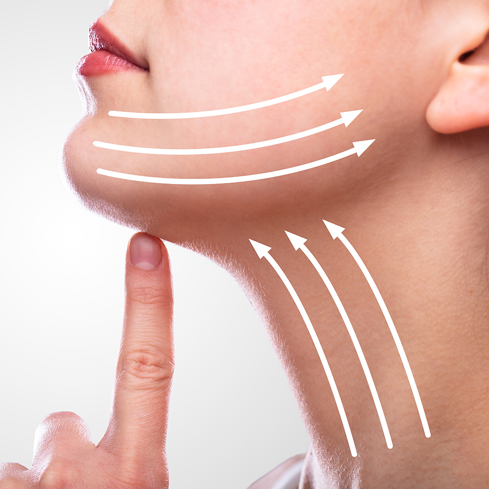 facelift surgery London, natural facelift results, facial contouring