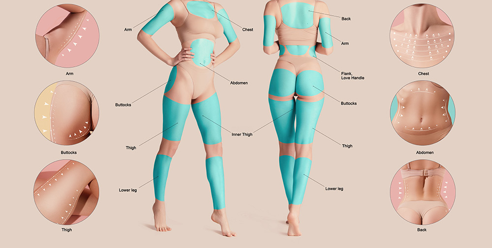 liposuction areas, body contouring zones, abdomen and waist liposuction, common liposuction areas