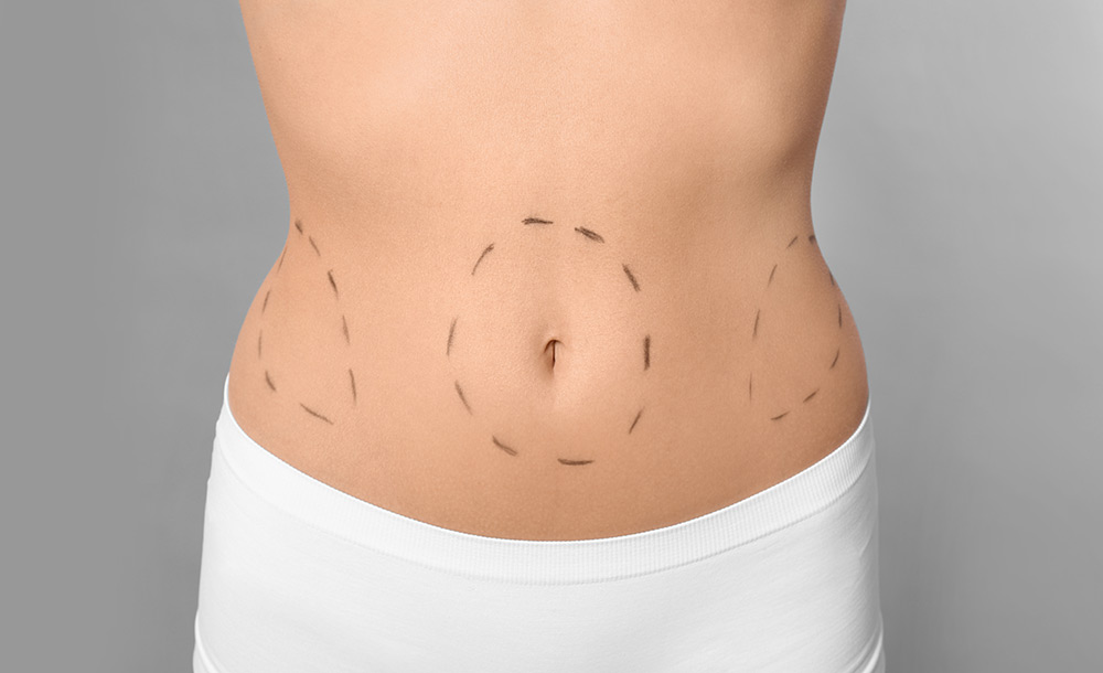 mini tummy tuck vs full tummy tuck, mini abdominoplasty vs full abdominoplasty, abdominal contour differences, tummy tuck comparison guide