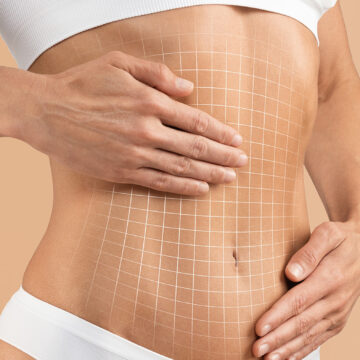 benefits of a tummy tuck tummy tuck after weight loss tummy tuck after pregnancy tummy tuck benefits