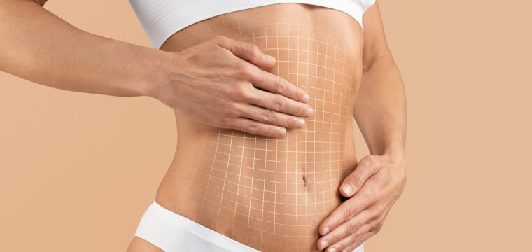 benefits of a tummy tuck tummy tuck after weight loss tummy tuck after pregnancy tummy tuck benefits